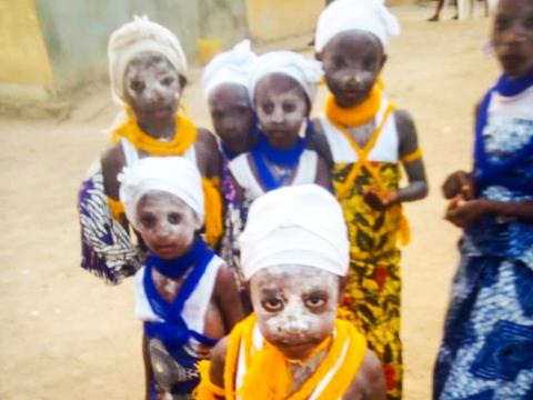 Recent underaged FGM initiates in the southern region of Sierra Leone Recent underaged FGM initiates in the southern region of Sierra Leone