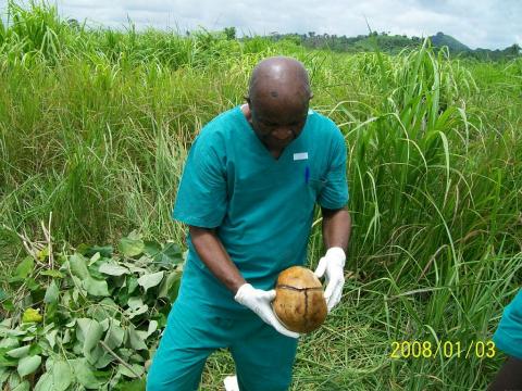 Dr Owizz Koroma with the exhumed skull of one of the deceased Dr Owizz Koroma with the exhumed skull of one of the deceased